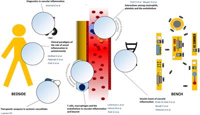 Editorial: Vascular Inflammation in Systemic Autoimmunity